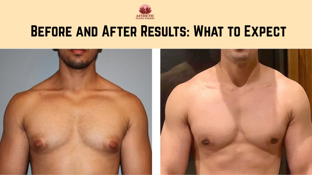 Before and After Results: What to Expect