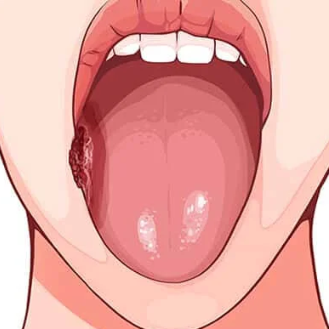 oral oral